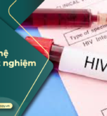 Sau khi quan hệ bao lâu thì xét nghiệm HIV chính xác?